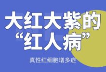 大红大紫的“红人病”——真性红细胞增多症-CHINA320-血液疾病病友之家