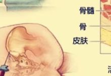 听起来就很痛的骨髓穿刺和骨髓活检，真的很可怕吗？-CHINA320-血液疾病病友之家