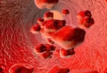 认识疾病 – IDH突变在急性髓性白血病靶向治疗中的临床应用-CHINA320-血液疾病病友之家